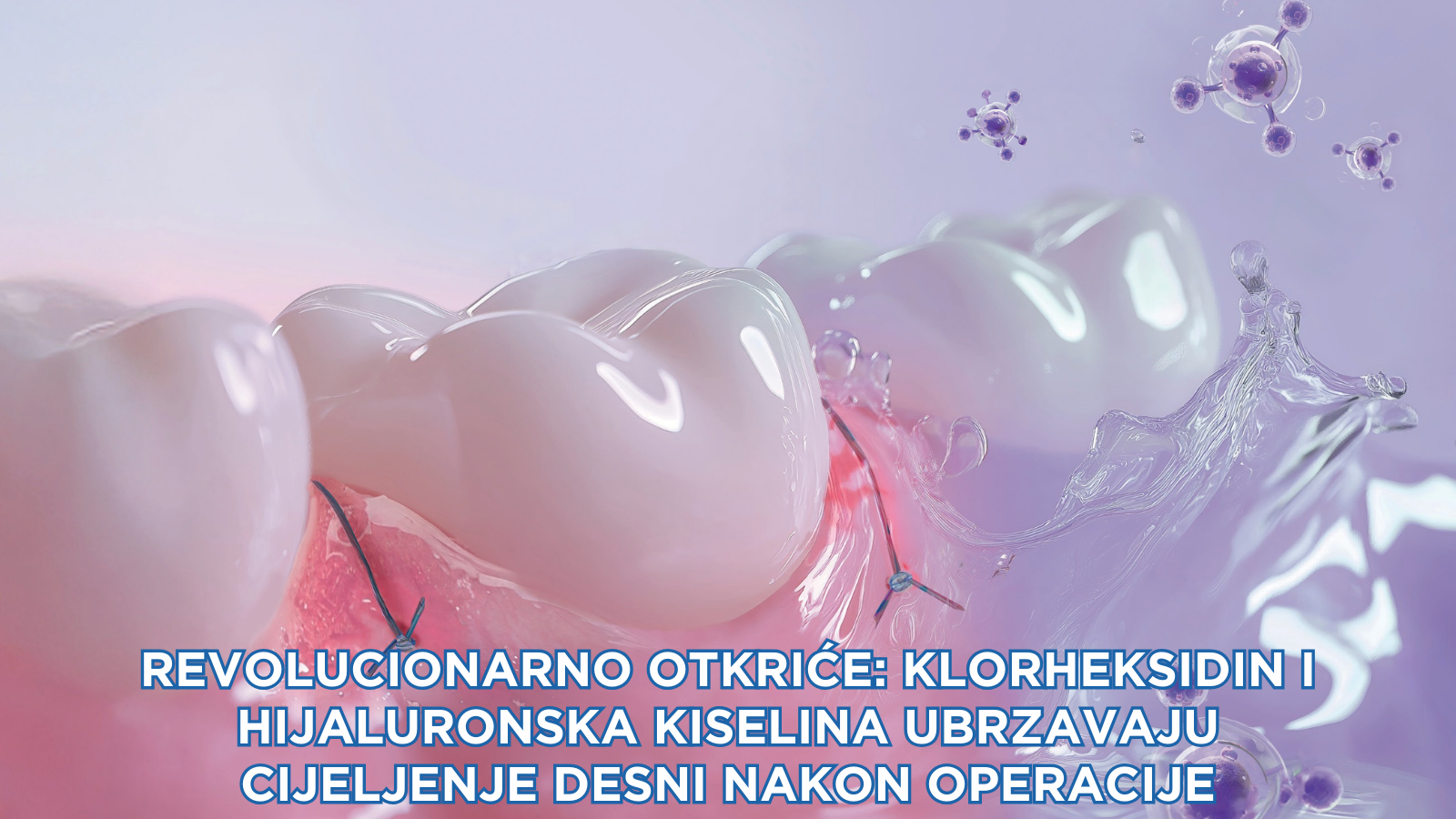 Revolucionarno otkriće: klorheksidin i hijaluronska kiselina ubrzavaju cijeljenje desni nakon operacije (nova studija 2024.)