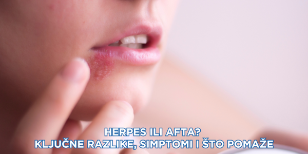 Herpes ili afta? Ključne razlike, simptomi i što pomaže