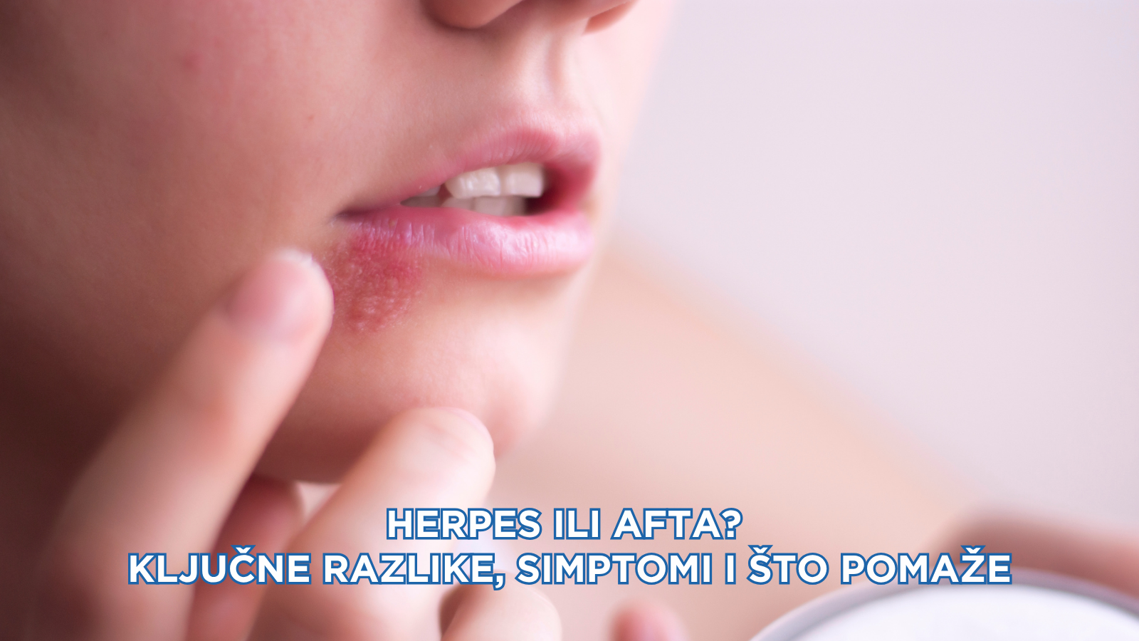 Herpes ili afta? Ključne razlike, simptomi i što pomaže